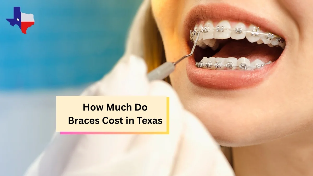 How Much Do Braces Cost in Texas